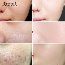 Glycyrrhiza Face Pore Repair Serum main product bottle on white background.