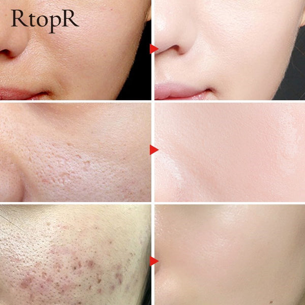 Glycyrrhiza Face Pore Repair Serum main product bottle on white background.