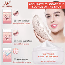 Mei YanQiong Dark Spot Remover Cream applied to face for dark spot treatment and brightening.