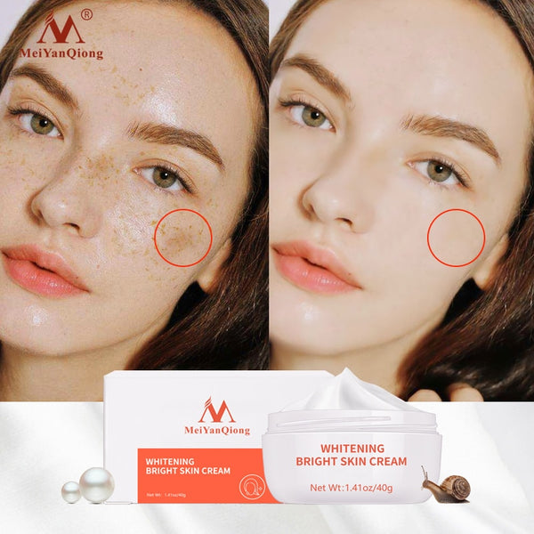 Mei YanQiong Dark Spot Remover Cream 40g main product jar on white background.