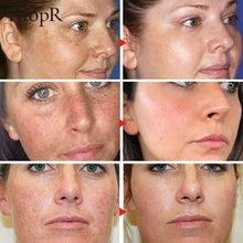 RtopR Anti-Aging Shrink Pore Whitening Face Serum vitamin C and snail filtrate ingredients display.
