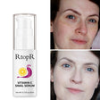 RtopR Anti-Aging Shrink Pore Whitening Face Serum main product bottle on white background.