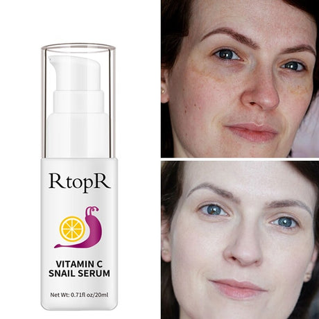 RtopR Anti-Aging Shrink Pore Whitening Face Serum main product bottle on white background.