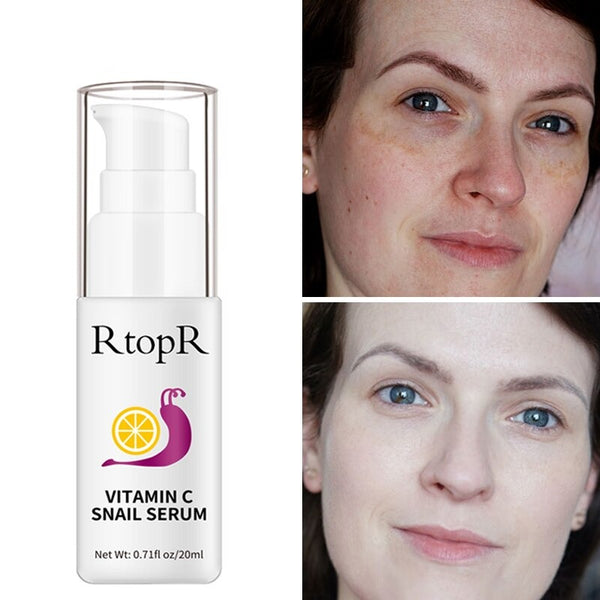 RtopR Anti-Aging Shrink Pore Whitening Face Serum main product bottle on white background.
