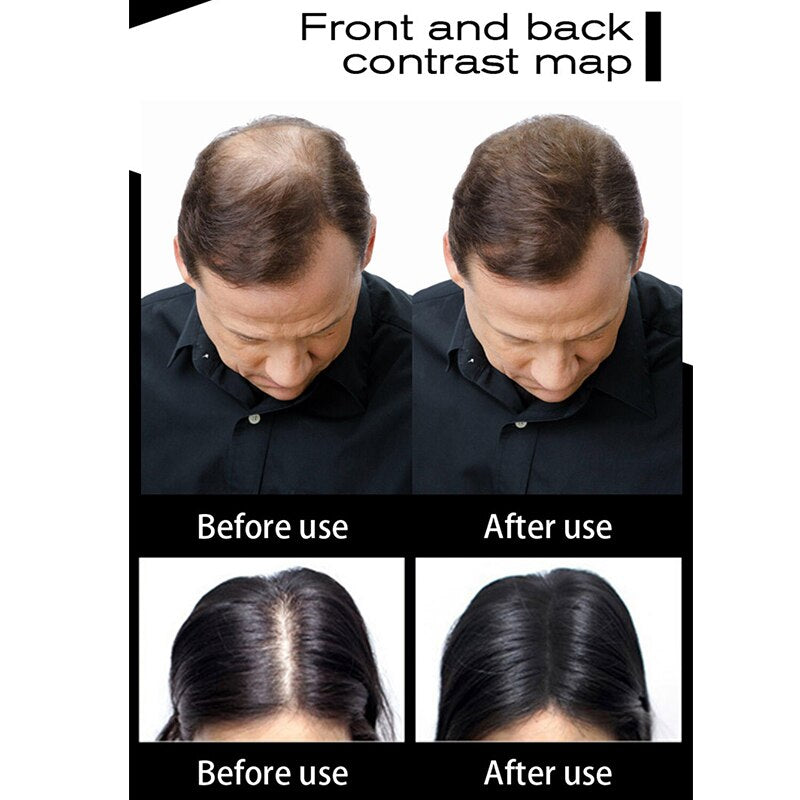 Sevich 100g Hair Fibers Refill application demonstration on thinning hair.