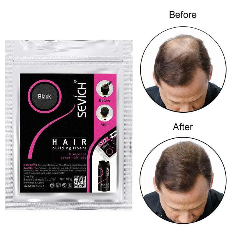 Sevich 100g Hair Fibers Refill showing available color selection options.