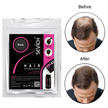 Sevich 100g Hair Fibers Refill showing available color selection options.