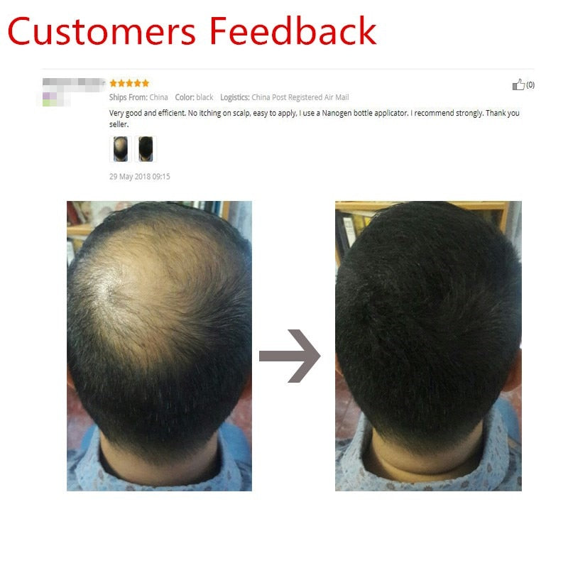 Sevich Hair Building Fibers Keratin coverage demonstration on sparse hair area.