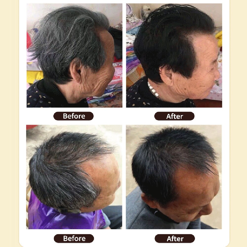 500ml 3 In 1 Black Hair Color Shampoo showing gray hair coverage result.